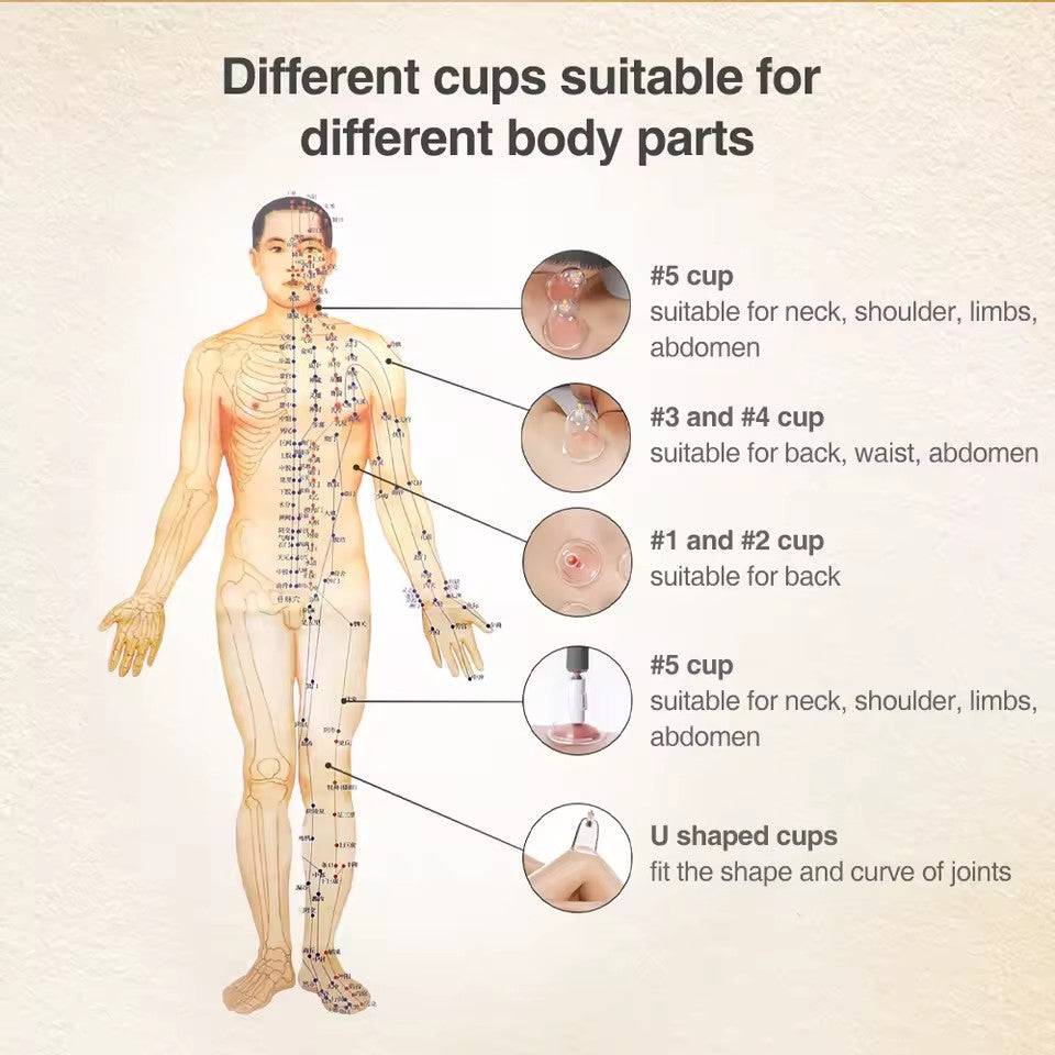 18pcs Suction Vacuum Cupping Set